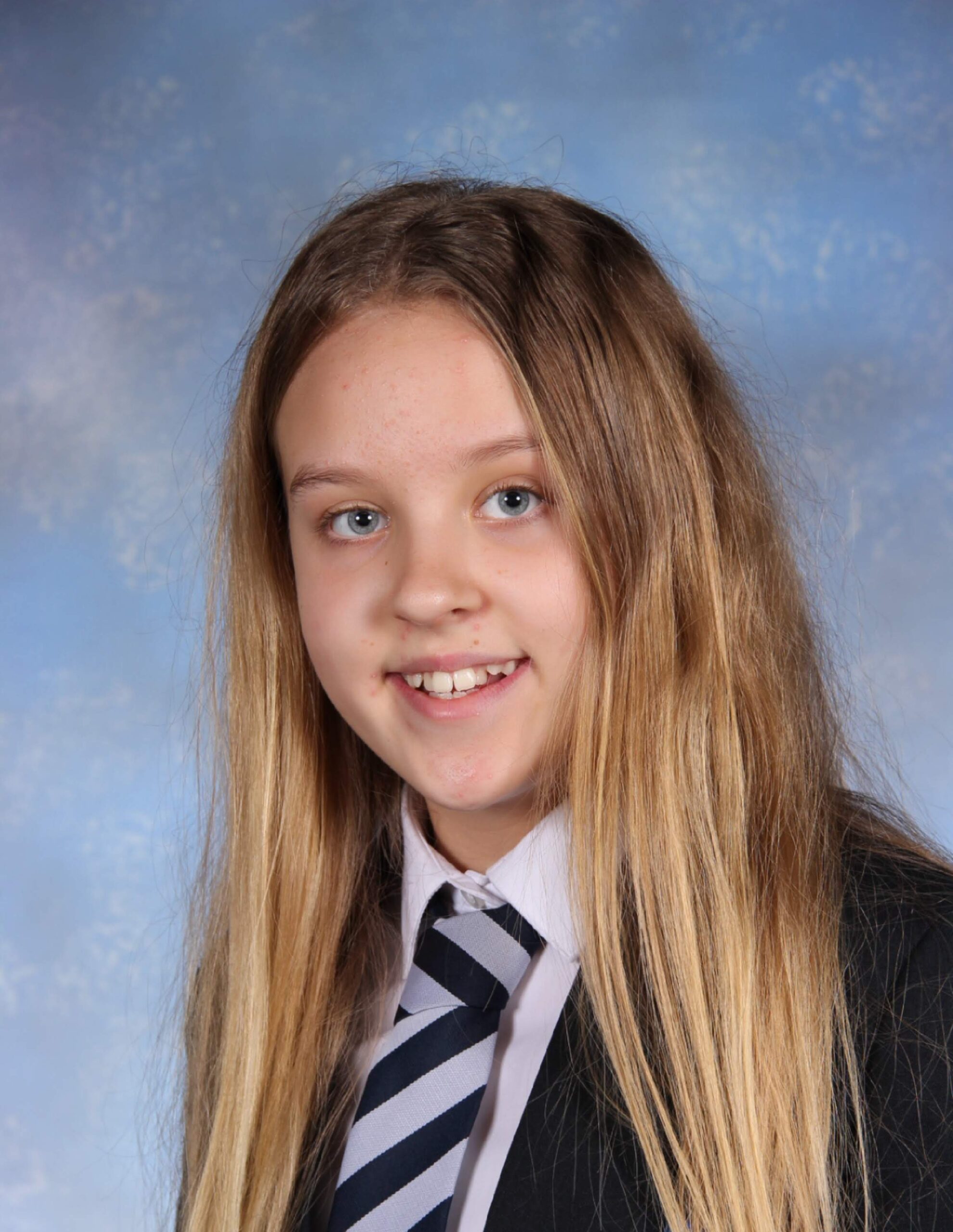 FND Awareness Day UK 25th March 2021 | Summer’s Story